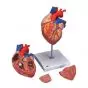 Enlarged heart G12