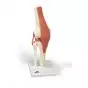 Deluxe Functional Knee Joint Model A82/1