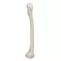 Femur, right A35/1R