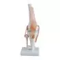 Mediprem Knee Joint Model 