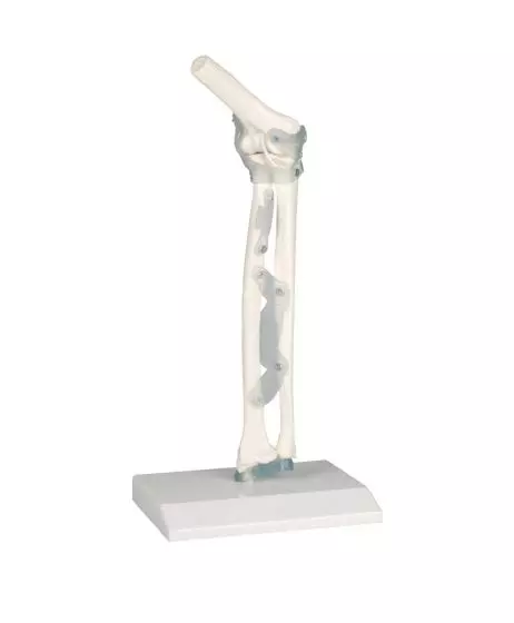 Elbow joint with ligaments Erler Zimmer