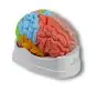 Brain functional / regional 5-parts Erler Zimmer