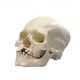 Human Skull with Cleft Jaw and Palate A29/3