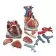 3 times Enlarged Heart on Diaphragm model VD251