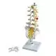 Lumbar Spinal Column with dorso-lateral prolapsed intervertebral disc A76/5