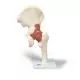 Deluxe Functional Hip Joint Model A81/1