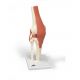 Deluxe Functional Knee Joint Model A82/1