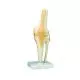 Functional Knee Joint A82