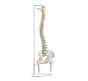 Column with femur stump - Mediprem