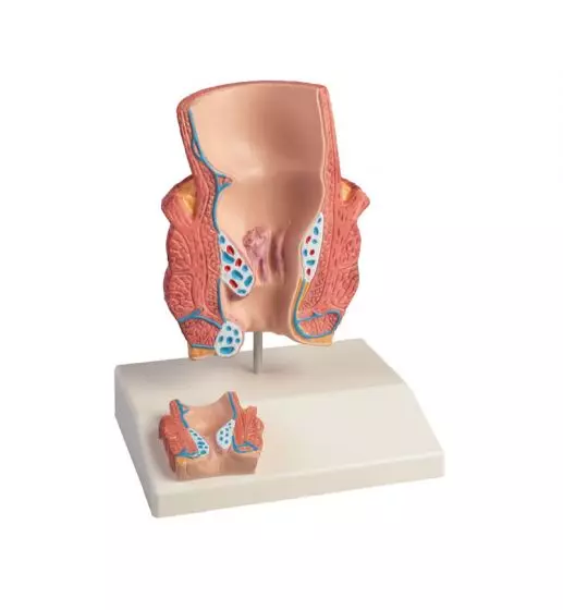 Haemorrhoid Model 2x life size Erler Zimmer