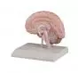 Model of the right brain half Erler Zimmer