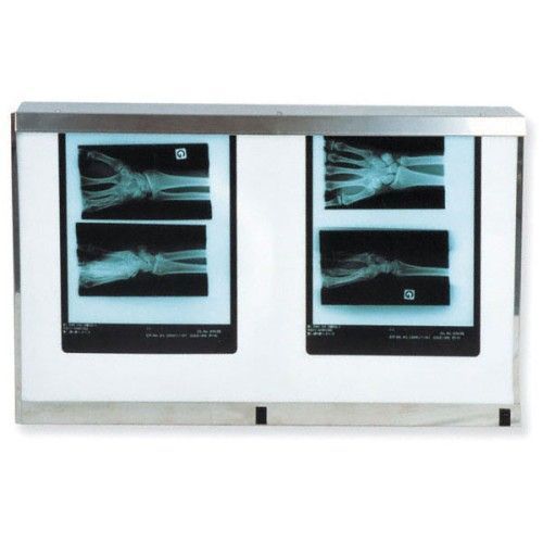X Ray Viewer Double Panel Standard With Switch 54w For 300 00