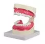 Oral hygiene model 1.5x life size Erler Zimmer