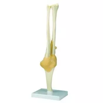 Functional Elbow Joint A83