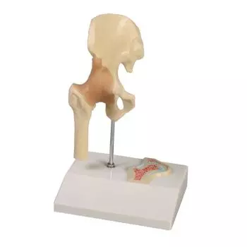 Miniature hip joint with cross section Erler Zimmer