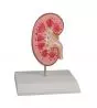 Kidney Stone Model real life size Erler Zimmer