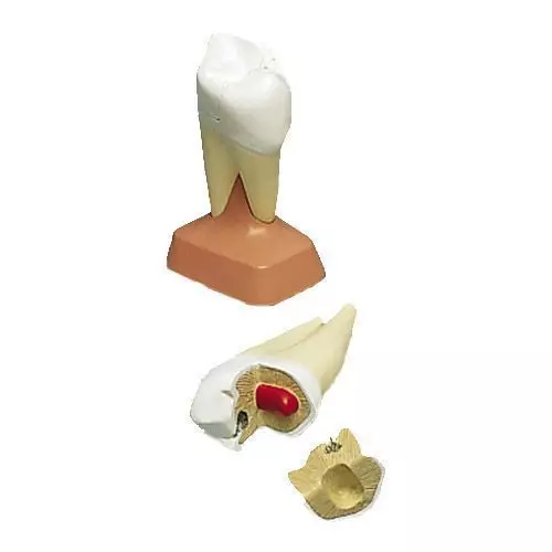Upper Molar with double root and cavities VE299