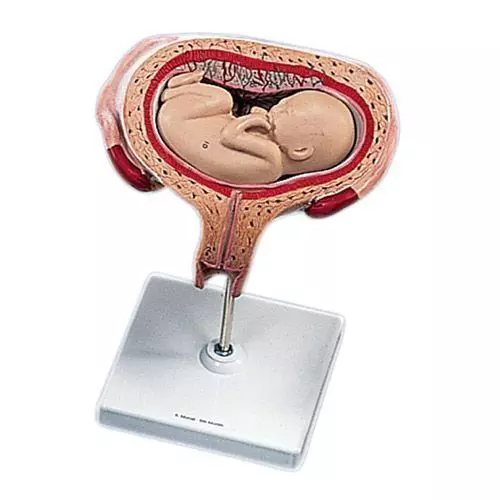 Fetal development, transverse lie, 5th Month L10/6