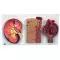 Kidney, Nephrons and Blood Vessels, Renal Corpuscle - Anatomical Model K11