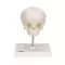 Fetal Skull model, natural cast, 30th week of pregnancy, on stand A26