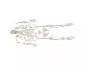Disassembled human skeleton model - Mediprem